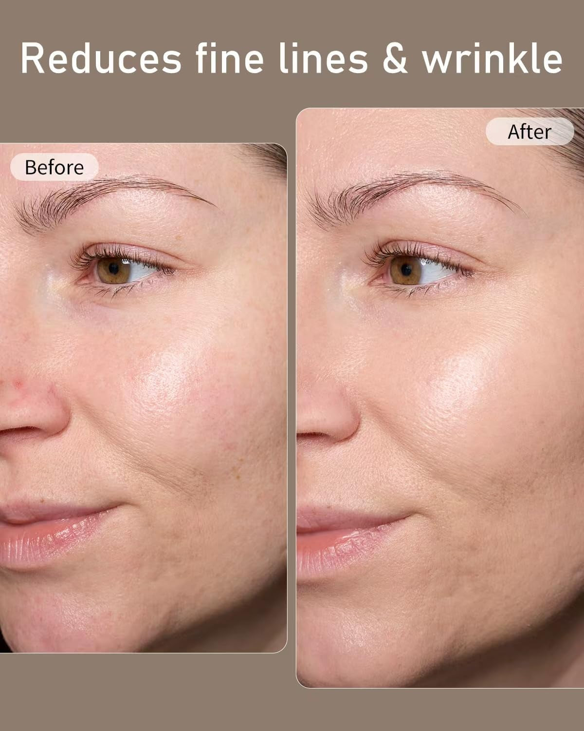 LED Face Mask, Red Light Therapy Mask, Five Modes Blue Light Therpay, Face Zone Maping, Remote Control, 4000Mah, Storage Bag, Head Strap, Eye Pads(S/M/L), Gift for Wife, Girls(White)