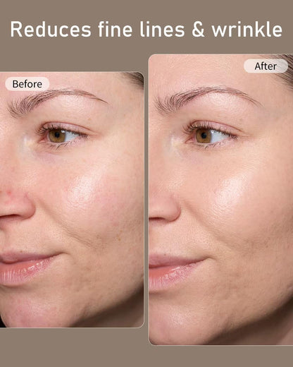 LED Face Mask, Red Light Therapy Mask, Five Modes Blue Light Therpay, Face Zone Maping, Remote Control, 4000Mah, Storage Bag, Head Strap, Eye Pads(S/M/L), Gift for Wife, Girls(White)